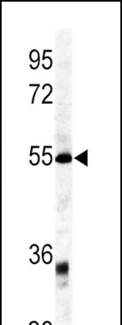 Invitrogen GDF6 Polyclonal Antibody 400 μL; Unconjugated:Antibodies,