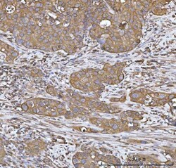 Invitrogen Heme oxygenase 2 Polyclonal Antibody 100 μg; Unconjugated:Antibodies,