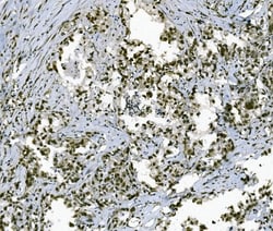 Invitrogen TAF4 Polyclonal Antibody 100 &mu;g; Unconjugated:Antibodies,
