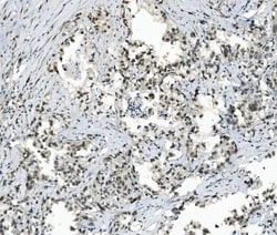 Invitrogen TAF4 Polyclonal Antibody 100 &mu;g; Unconjugated:Antibodies,