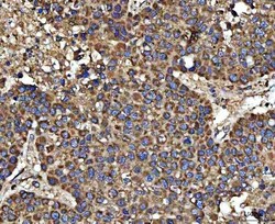 Invitrogen HSD17B7 Polyclonal Antibody 100 &mu;g; Unconjugated:Antibodies,
