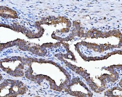 Invitrogen HSD17B7 Polyclonal Antibody 100 &mu;g; Unconjugated:Antibodies,