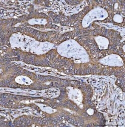 Invitrogen HSD17B7 Polyclonal Antibody 100 &mu;g; Unconjugated:Antibodies,