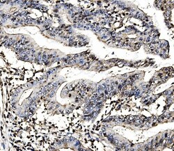 Invitrogen MORC3 Polyclonal Antibody 100 &mu;g | Buy Online | Invitrogen&trade; | Fisher Scientific