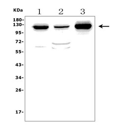Invitrogen MORC3 Polyclonal Antibody 100 &mu;g | Buy Online | Invitrogen&trade; | Fisher Scientific