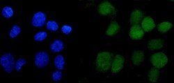 Invitrogen ANAPC2 Polyclonal Antibody 100 μg; Unconjugated:Antibodies,