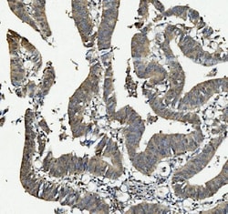 Invitrogen ANAPC2 Polyclonal Antibody 100 μg; Unconjugated:Antibodies,