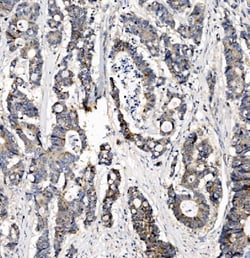 Invitrogen CHCHD10 Polyclonal Antibody 100 &mu;g | Buy Online | Invitrogen&trade; | Fisher Scientific