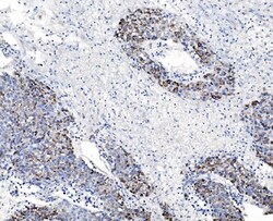 Invitrogen CHCHD10 Polyclonal Antibody 100 &mu;g | Buy Online | Invitrogen&trade; | Fisher Scientific