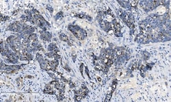 Invitrogen CHCHD10 Polyclonal Antibody 100 &mu;g | Buy Online | Invitrogen&trade; | Fisher Scientific