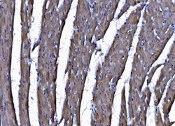 Invitrogen CHCHD10 Polyclonal Antibody 100 &mu;g | Buy Online | Invitrogen&trade; | Fisher Scientific