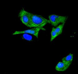 Invitrogen ATP11C Polyclonal Antibody 100 &mu;g; Unconjugated:Antibodies,