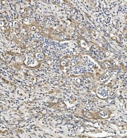 Invitrogen SEMA6A Polyclonal Antibody 100 &mu;g; Unconjugated:Antibodies,