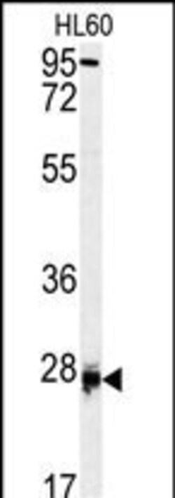 Invitrogen DPT Polyclonal Antibody 400 &mu;L; Unconjugated:Antibodies,