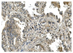 Invitrogen MESP2 Polyclonal Antibody 100 &mu;g; Unconjugated:Antibodies,