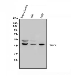 Invitrogen MESP2 Polyclonal Antibody 100 &mu;g; Unconjugated:Antibodies,