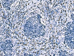 Invitrogen CD101 Polyclonal Antibody 100 &mu;g; Unconjugated:Antibodies,