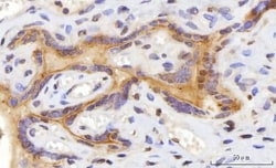 Invitrogen CEP250 Polyclonal Antibody 100 &mu;g; Unconjugated:Antibodies,