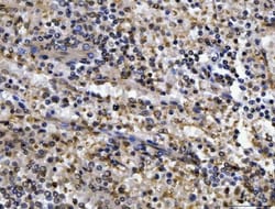 Invitrogen CEP250 Polyclonal Antibody 100 &mu;g; Unconjugated:Antibodies,