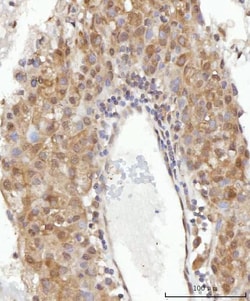Invitrogen CEP250 Polyclonal Antibody 100 &mu;g; Unconjugated:Antibodies,