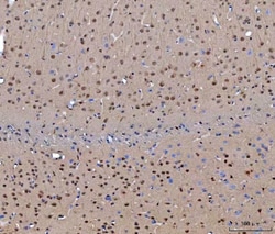 Invitrogen CEP250 Polyclonal Antibody 100 &mu;g; Unconjugated:Antibodies,