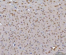 Invitrogen CEP250 Polyclonal Antibody 100 &mu;g; Unconjugated:Antibodies,