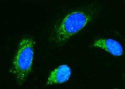 Invitrogen CD89 Polyclonal Antibody 100 &mu;g; Unconjugated:Antibodies,
