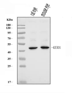 Invitrogen Keratocan Polyclonal Antibody 100 &mu;g; Unconjugated:Antibodies,