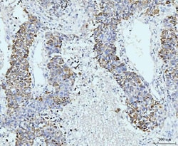 Invitrogen GSPT1/2 Polyclonal Antibody 100 &mu;g | Buy Online | Invitrogen&trade; | Fisher Scientific