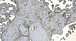 Invitrogen DNAJC10 Polyclonal Antibody 100 &mu;g | Buy Online | Invitrogen&trade; | Fisher Scientific