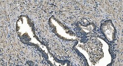 Invitrogen DNAJC10 Polyclonal Antibody 100 &mu;g | Buy Online | Invitrogen&trade; | Fisher Scientific