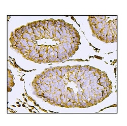 Invitrogen Nectin 2 Polyclonal Antibody 100 &mu;g; Unconjugated:Antikroppar