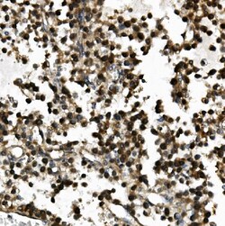 Invitrogen USP44 Polyclonal Antibody 100 &mu;g; Unconjugated:Antibodies,