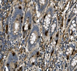 Invitrogen USP44 Polyclonal Antibody 100 &mu;g; Unconjugated:Antibodies,