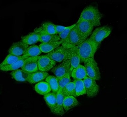 Invitrogen LAR4B Polyclonal Antibody 100 &mu;g; Unconjugated:Antibodies,