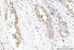 Invitrogen LAR4B Polyclonal Antibody 100 &mu;g; Unconjugated:Antibodies,