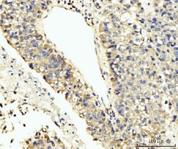 Invitrogen LAR4B Polyclonal Antibody 100 &mu;g; Unconjugated:Antibodies,