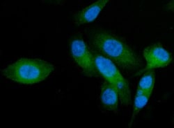 Invitrogen AP2A2 Polyclonal Antibody 100 &mu;g; Unconjugated:Antibodies,