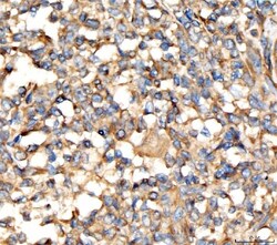 Invitrogen AP2A2 Polyclonal Antibody 100 &mu;g; Unconjugated:Antibodies,