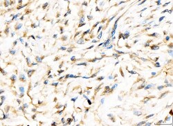 Invitrogen AP2A2 Polyclonal Antibody 100 &mu;g; Unconjugated:Antibodies,