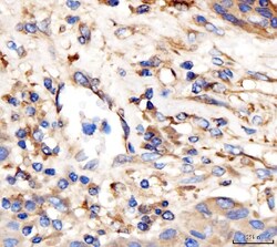 Invitrogen AP2A2 Polyclonal Antibody 100 &mu;g; Unconjugated:Antibodies,