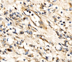 Invitrogen AP2A2 Polyclonal Antibody 100 &mu;g; Unconjugated:Antibodies,