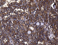 Invitrogen KLHL12 Polyclonal Antibody 100 &mu;g; Unconjugated:Antibodies,