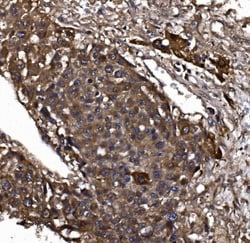 Invitrogen KLHL12 Polyclonal Antibody 100 &mu;g; Unconjugated:Antibodies,