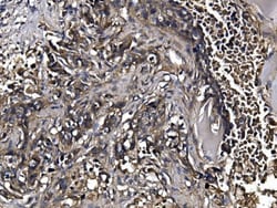 Invitrogen KLHL12 Polyclonal Antibody 100 &mu;g; Unconjugated:Antibodies,