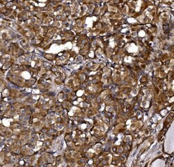 Invitrogen KLHL12 Polyclonal Antibody 100 &mu;g; Unconjugated:Antibodies,