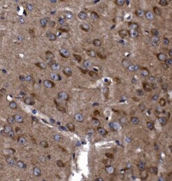 Invitrogen KLHL12 Polyclonal Antibody 100 &mu;g; Unconjugated:Antibodies,