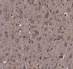 Invitrogen KLHL12 Polyclonal Antibody 100 &mu;g; Unconjugated:Antibodies,