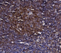 Invitrogen KLHL12 Polyclonal Antibody 100 &mu;g; Unconjugated:Antibodies,