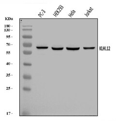 Invitrogen KLHL12 Polyclonal Antibody 100 &mu;g; Unconjugated:Antibodies,